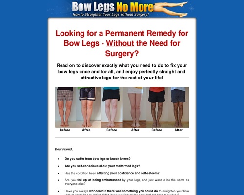 Bow Legs No More – How to Straighten Your Legs Without Surgery!