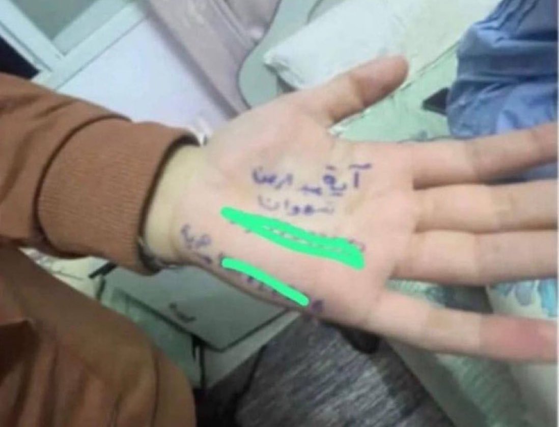 Gaza Children Write Names on Hands to Be Identified After Bombings